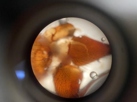 Bug parts under microscope